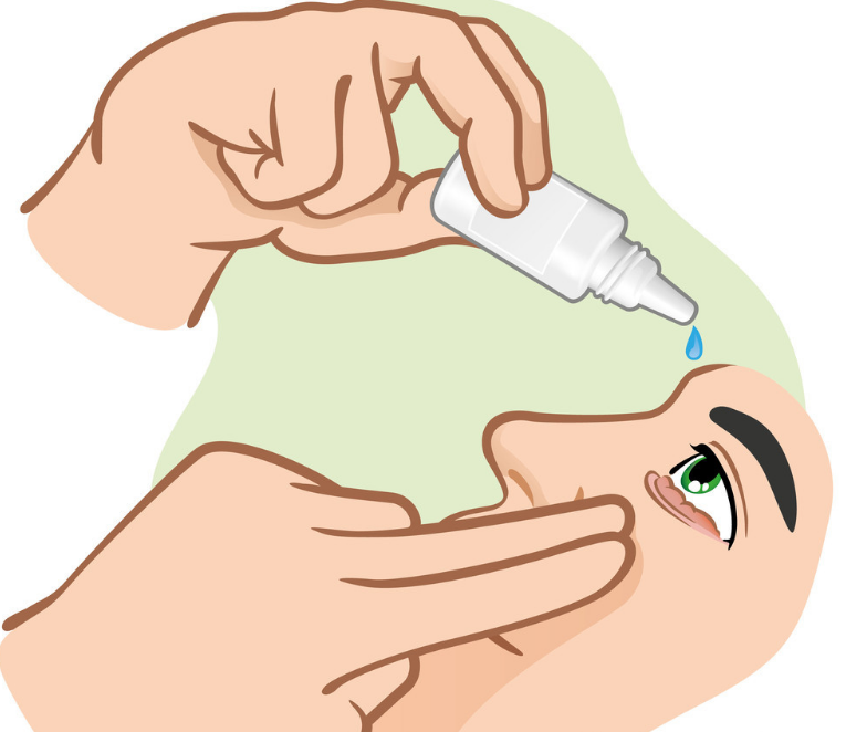 滴眼药水能治干眼症吗?